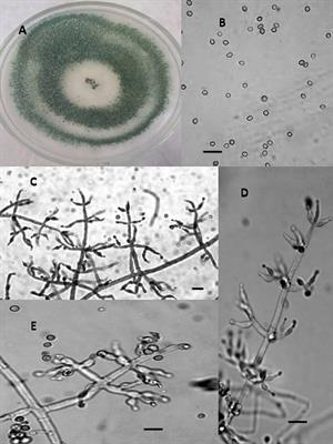 Antiproliferative and Antimicrobial Activities of Secondary Metabolites and Phylogenetic Study of Endophytic Trichoderma Species From Vinca Plants